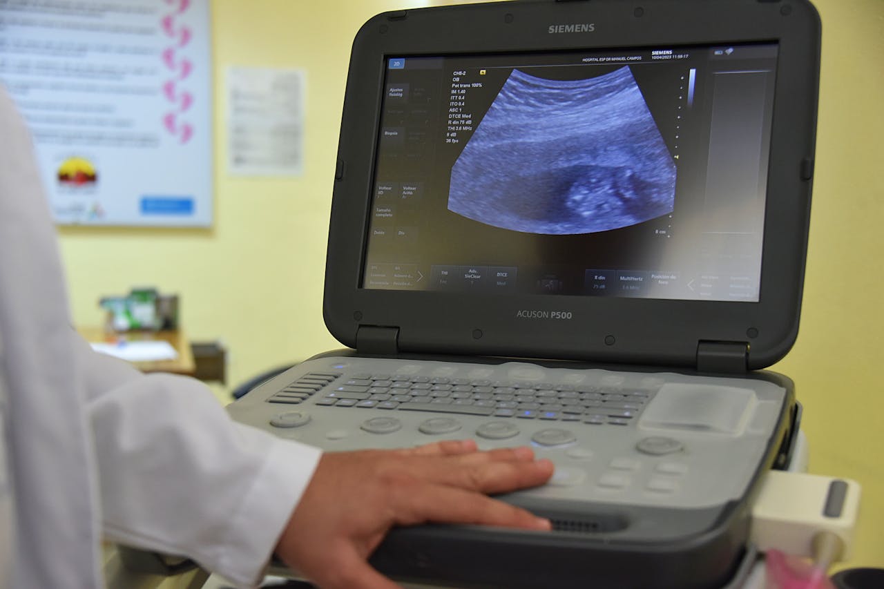 Close-up of a hand operating an ultrasound machine, with an ultrasound image on the screen.