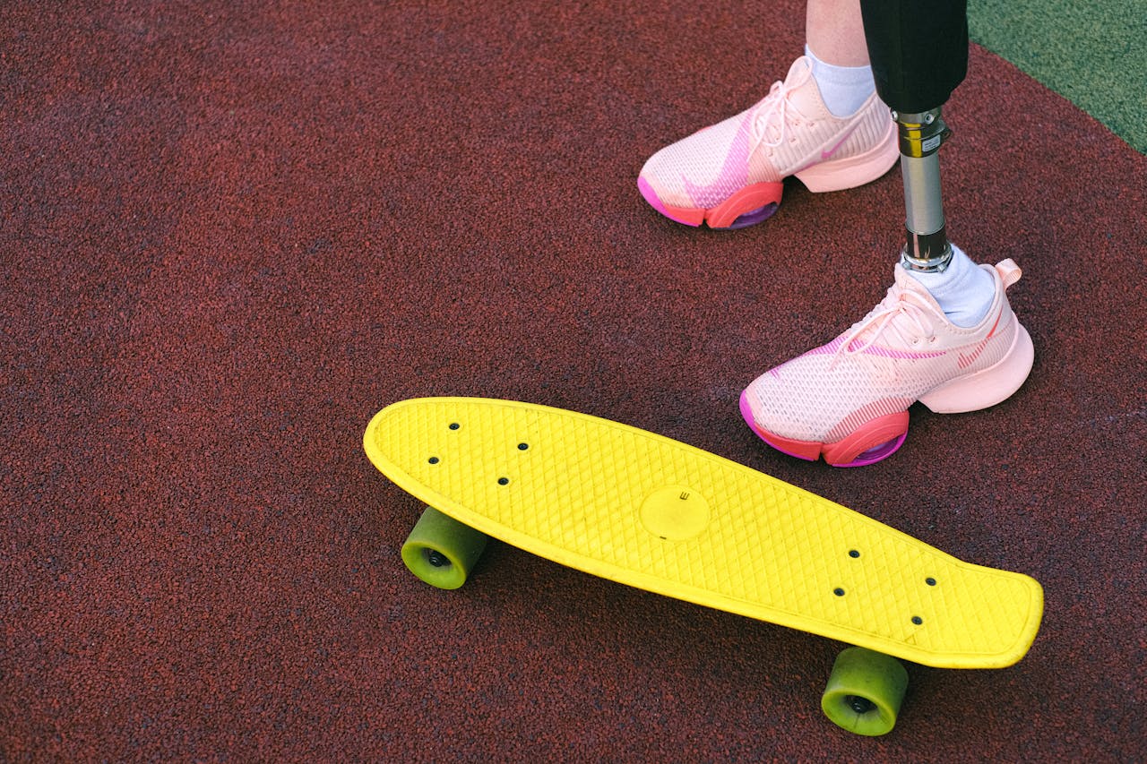 Skateboard A lady with pink trousers and a prosthetic leg stands next to a penny board.